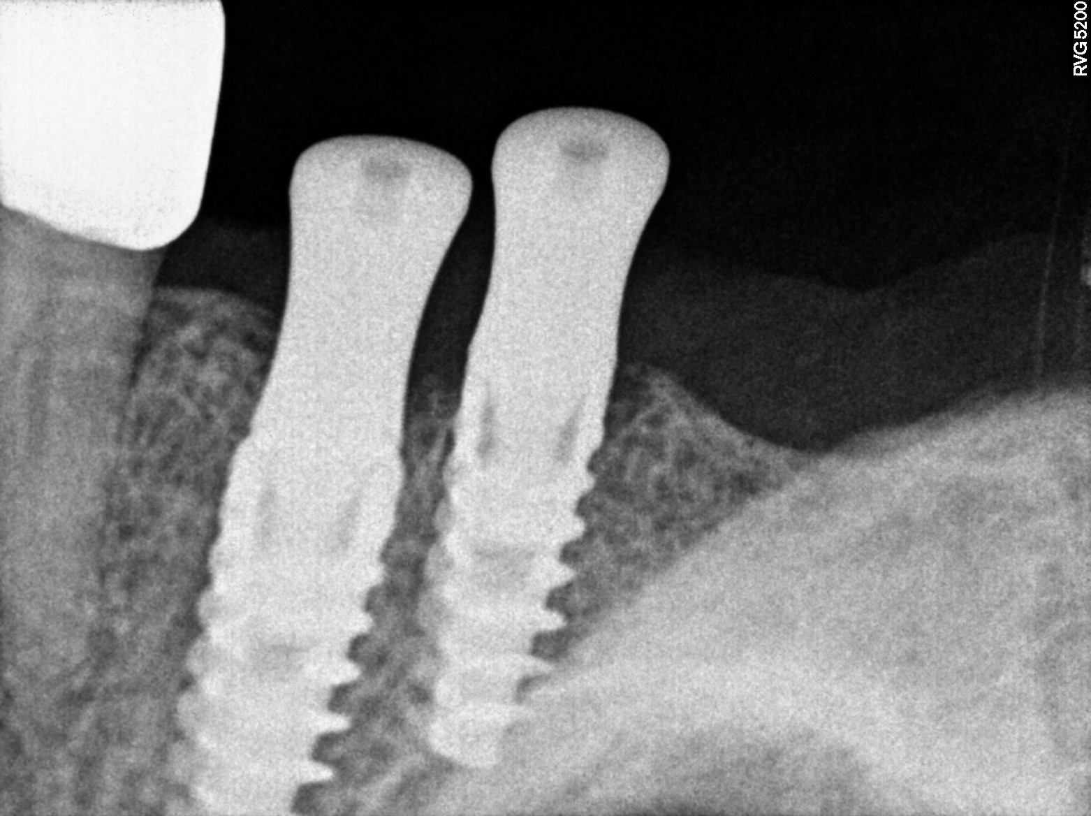 Dental X-ray
